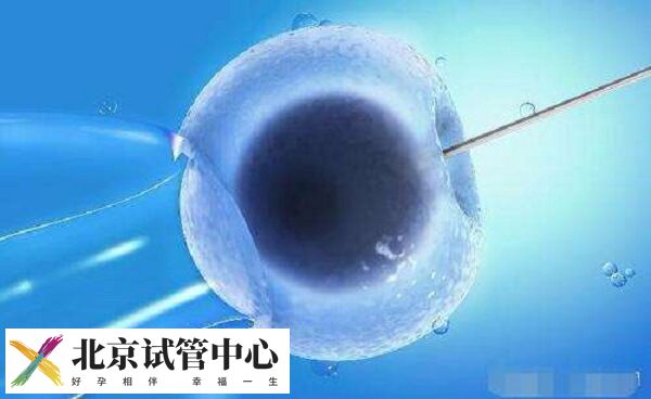 北京私立医院做试管婴儿可以选性别生男孩吗？(图1)