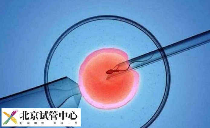 试管可以自己选一代还是二代吗?医生才是最后的决策者