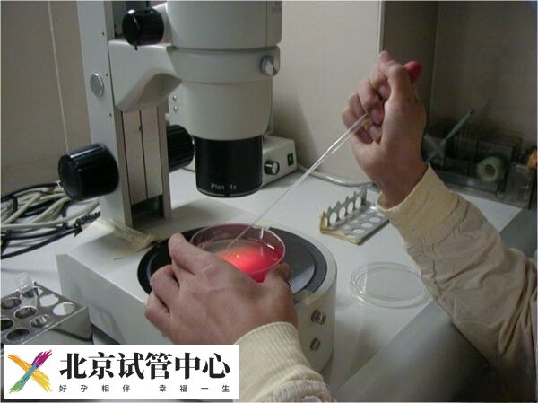 北京三代试管婴儿能不能避免秃顶(图1)