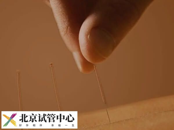 取卵后针灸有没有用(图2) 取卵后针灸有没有用(图2)