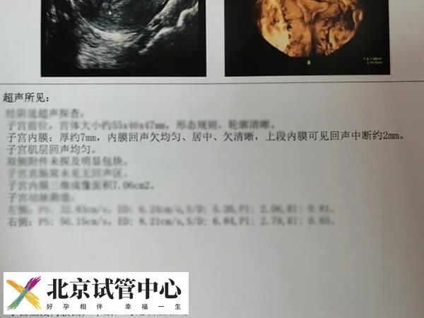 做试管宫腔粘连怎么办