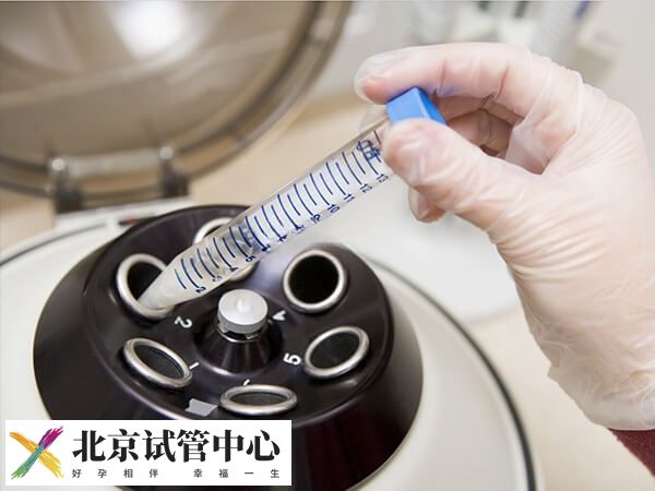 三代试管能筛查什么病
