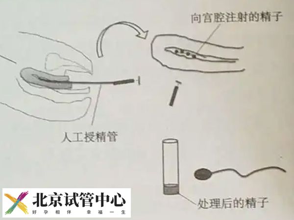 实施人授后能不能再屁股底下垫枕头