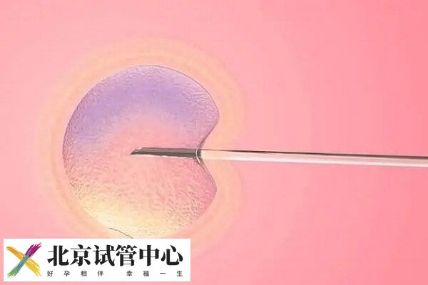 北京协和医院做一代试管婴儿促排移植全套费用多少？