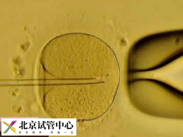 单囊胚移植的优劣势分析,降低多胎妊娠风险是优点之一(图1) 单囊胚移植的优劣势分析,降低多胎妊娠风险是优点之一(图1)