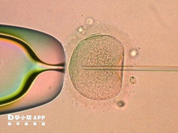 桥本甲状腺炎做试管比较好还是自然受孕好(图2) 桥本甲状腺炎做试管比较好还是自然受孕好(图2)