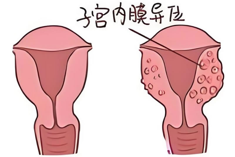 三代试管婴儿 北京朝阳医院试管婴儿好么?(北京朝阳医院试管)(图1)